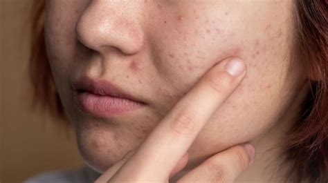 7 Cara Kilat Hilangkan Pori-Pori Tangan Kasar, Hasilnya Bikin Pangling!