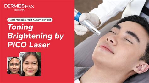 7 Treatment Laser Wajah Murah Meriah: Wajah Glowing Mulai dari Rp50 Ribu! 7 Treatment Laser Wajah Murah Meriah: Wajah Glowing Mulai dari Rp50 Ribu!