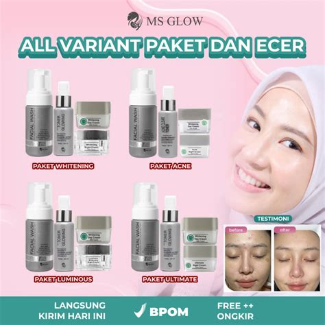 5 Jurus MS Glow Bye-Bye Jerawat and Kilap di Wajah Berminyak! 5 Jurus MS Glow Bye-Bye Jerawat and Kilap di Wajah Berminyak!