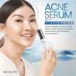 5 Jurus MS Glow Bye-Bye Jerawat and Kilap di Wajah Berminyak!