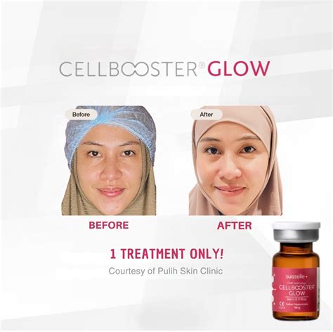 5 Rahasia Alami Bikin Wajah Glow Up, Bye-Bye Kusam! 💫