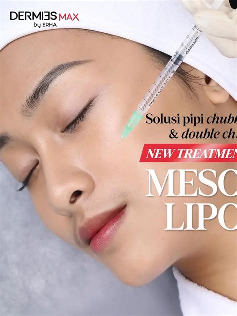 5 Rahasia Ampuh Atasi Pipi Kendur: Bye-bye Wajah Tua! 5 Rahasia Ampuh Atasi Pipi Kendur: Bye-bye Wajah Tua!