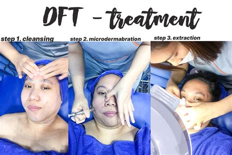 5 Treatment NMW Skincare Harga Terkejut, Wajah Glowing Cuma Segini! 5 Treatment NMW Skincare Harga Terkejut, Wajah Glowing Cuma Segini!