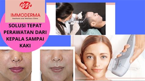 7 Bahan Alami dalam Immoderma Skincare yang Bisa Menghilangkan Jerawat dalam 3 Minggu! 7 Bahan Alami dalam Immoderma Skincare yang Bisa Menghilangkan Jerawat dalam 3 Minggu!