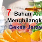 7 Bahan Alami dalam Immoderma Skincare yang Bisa Menghilangkan Jerawat dalam 3 Minggu!