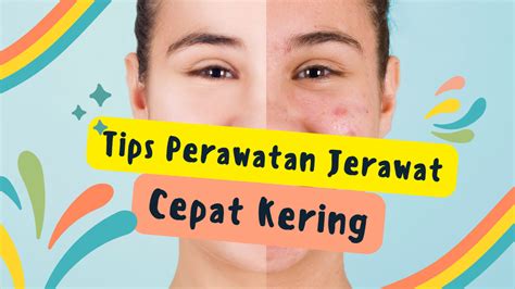 7 Cara Efektif Mengatasi Perawatan Kulit Kering Berjerawat yang Wajib Kamu Coba Hari Ini! 7 Cara Efektif Mengatasi Perawatan Kulit Kering Berjerawat yang Wajib Kamu Coba Hari Ini!