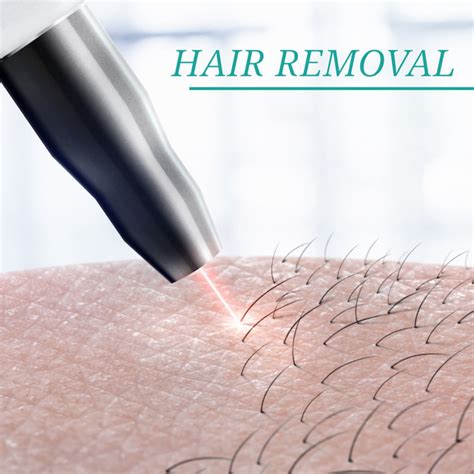 7 Cara Laser Perawatan Wajah yang Bisa Ubah Penampilanmu dalam Semalam! 7 Cara Laser Perawatan Wajah yang Bisa Ubah Penampilanmu dalam Semalam!