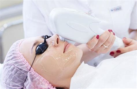 7 Cara Laser Perawatan Wajah yang Bisa Ubah Penampilanmu dalam Semalam! 7 Cara Laser Perawatan Wajah yang Bisa Ubah Penampilanmu dalam Semalam!