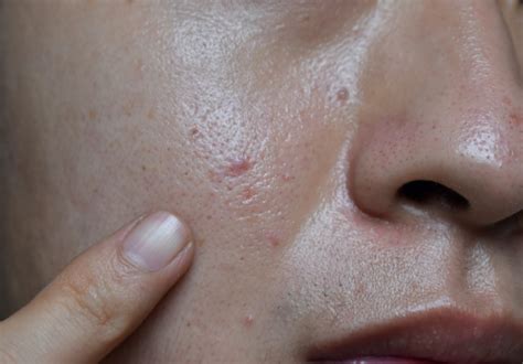 7 Rahasia Kulit Awet Muda: Ritual Anti-Aging yang Wajib Dicoba! 7 Rahasia Kulit Awet Muda: Ritual Anti-Aging yang Wajib Dicoba!