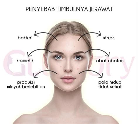 7 Rahasia  Kulit Wajah Sensitif and Berjerawat Bebas Bersahabat Pada Hidungku