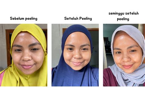 7 Treatment Erha Termurah 2021: Bye Kulit Kusam, Budget Aman! 7 Treatment Erha Termurah 2021: Bye Kulit Kusam, Budget Aman!