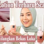 5 Alasan Serum Scarlett Ampuh Hilangkan Bekas Luka di Badan!
