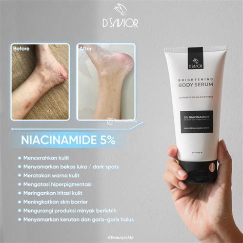 5 Alasan Serum Scarlett Ampuh Hilangkan Bekas Luka di Badan! 5 Alasan Serum Scarlett Ampuh Hilangkan Bekas Luka di Badan!