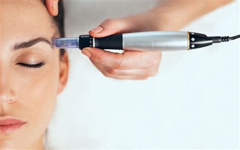 5 Rahasia Kulit Glowing Setelah Treatment Dermapen yang Wajib Kamu Tahu! 5 Rahasia Kulit Glowing Setelah Treatment Dermapen yang Wajib Kamu Tahu!