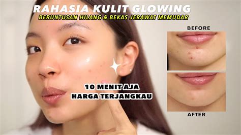 5 Rahasia Kulit Glowing Setelah Treatment Dermapen yang Wajib Kamu Tahu! 5 Rahasia Kulit Glowing Setelah Treatment Dermapen yang Wajib Kamu Tahu!
