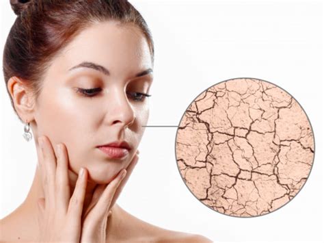7 Cara Ampuh Mengatasi Perawatan Wajah Kering dan Kusam yang Bisa Kamu Coba di Rumah! 7 Cara Ampuh Mengatasi Perawatan Wajah Kering dan Kusam yang Bisa Kamu Coba di Rumah!