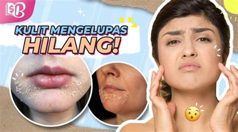 7 Cara Ampuh Mengatasi Perawatan Wajah Kering dan Kusam yang Bisa Kamu Coba di Rumah! 7 Cara Ampuh Mengatasi Perawatan Wajah Kering dan Kusam yang Bisa Kamu Coba di Rumah!