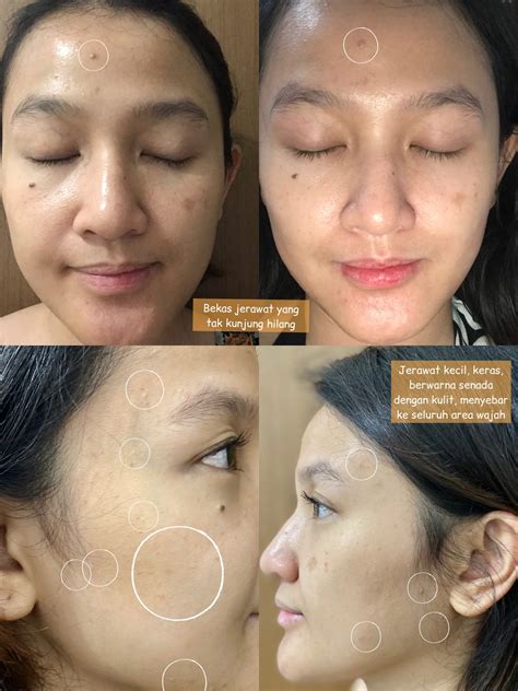 7 Cara Perawatan Wajah Erha yang Ampuh Membuat Kulitmu Mulus dan Bersinar dalam 1 Minggu! 7 Cara Perawatan Wajah Erha yang Ampuh Membuat Kulitmu Mulus dan Bersinar dalam 1 Minggu!