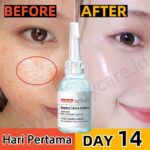 7 Serum Ampuh: Wajah Glowing, Pori-Pori Menciut!