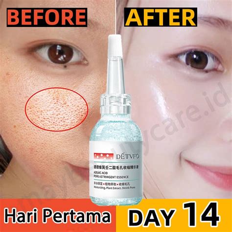 7 Serum Ampuh: Wajah Glowing, Pori-Pori Menciut! 7 Serum Ampuh: Wajah Glowing, Pori-Pori Menciut!