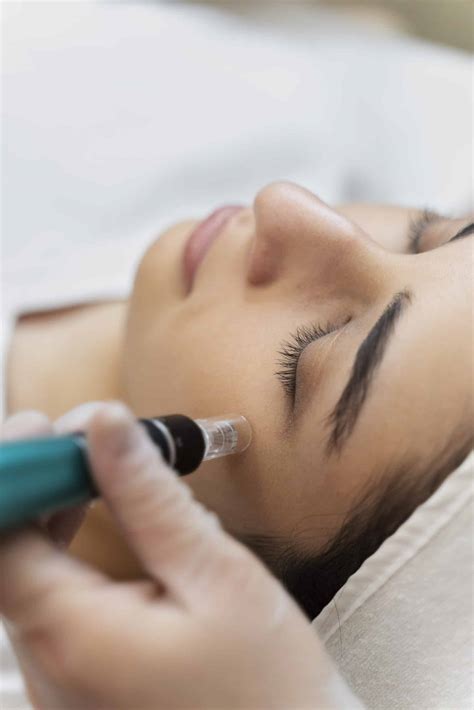 7 Tempat Treatment Dermapen Terdekat yang Bisa Mengubah Wajahmu dalam 1 Hari! 7 Tempat Treatment Dermapen Terdekat yang Bisa Mengubah Wajahmu dalam 1 Hari!