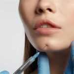 7 Tempat Treatment Dermapen Terdekat yang Bisa Mengubah Wajahmu dalam 1 Hari!