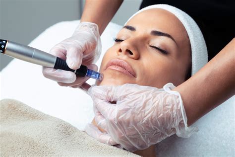 7 Tempat Treatment Dermapen Terdekat yang Bisa Mengubah Wajahmu dalam 1 Hari! 7 Tempat Treatment Dermapen Terdekat yang Bisa Mengubah Wajahmu dalam 1 Hari!