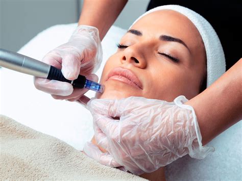 7 Tempat Treatment Dermapen Terdekat yang Bisa Mengubah Wajahmu dalam 1 Hari! 7 Tempat Treatment Dermapen Terdekat yang Bisa Mengubah Wajahmu dalam 1 Hari!