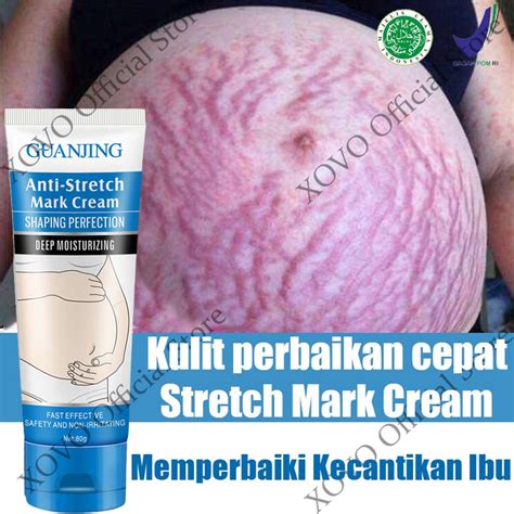 7 Treatment Ampuh Menghilangkan Stretch Mark dalam 30 Hari, Hasilnya Maksimal! 7 Treatment Ampuh Menghilangkan Stretch Mark dalam 30 Hari, Hasilnya Maksimal!